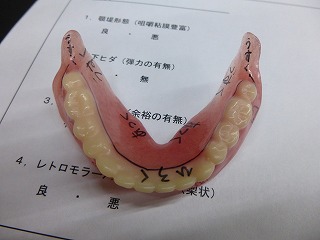 《やっぱりできる下顎総義歯吸着》セミナー | Dr.NAOの気まぐれ日記