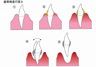 s-歯と歯肉１３(110500013)